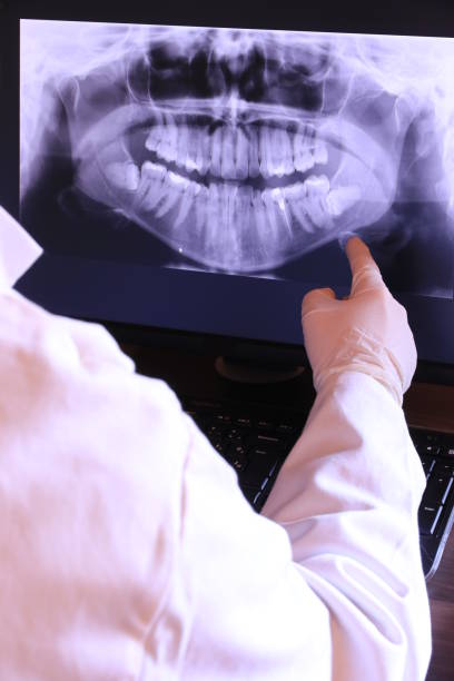 Best Emergency Tooth Extraction in Bedford, IA